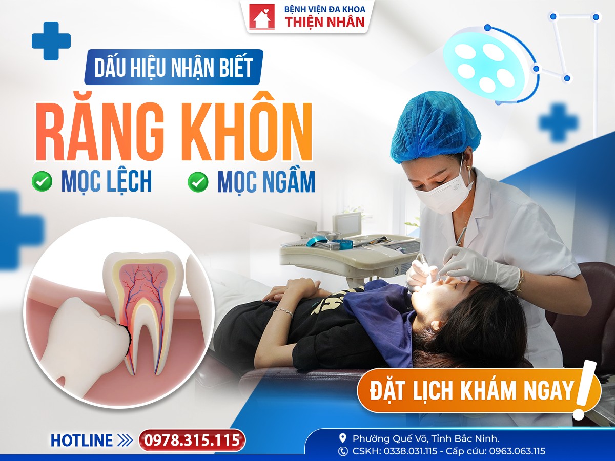 https://benhvienthiennhan.com/rang-khon-moc-lech-dau-hieu-nhan-biet-va-khi-nao-can-dieu-tri
